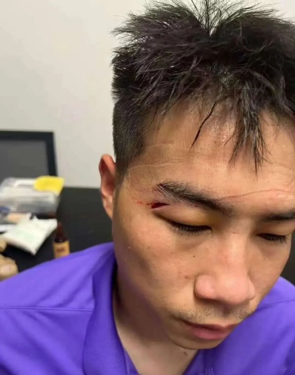 津媒：王献钧两颗门牙被撞断，杨帆眉骨负伤  赛后去医院缝针